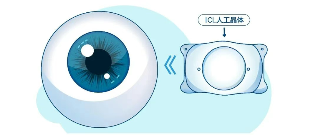 圖片.png 圖片.png